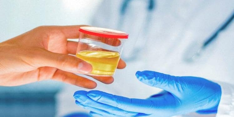 Everything to Know About Hair Drug Testing